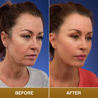 LIMETOW® Polypeptide Collagen Elastic Essence Cream