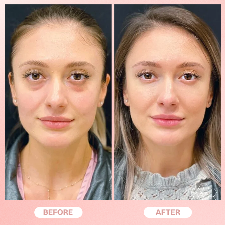 LIMETOW® Under Eye Brightener