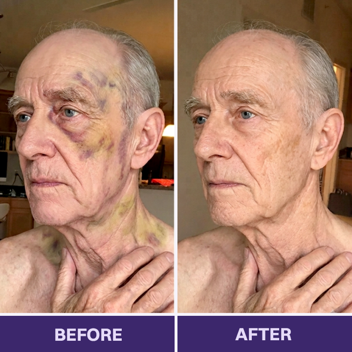LIMETOW® Bruise Repair & Skin-Strengthening Cream