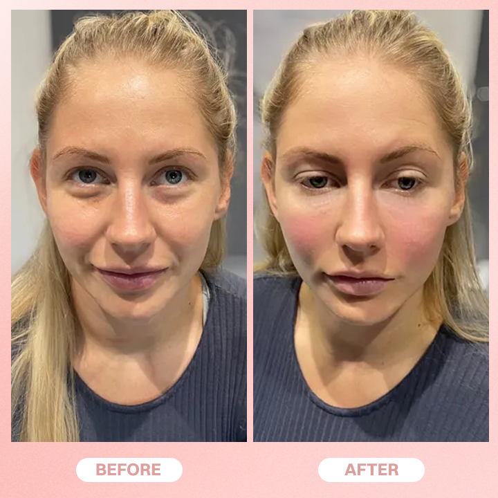 LIMETOW® Under Eye Brightener