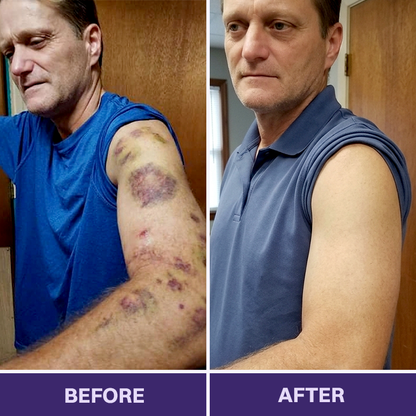 LIMETOW® Bruise Repair & Skin-Strengthening Cream