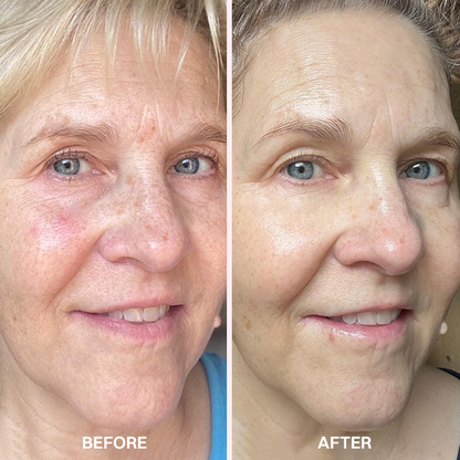 LIMETOW® REVERSE-AGING ADAPTIVE FOUNDATION