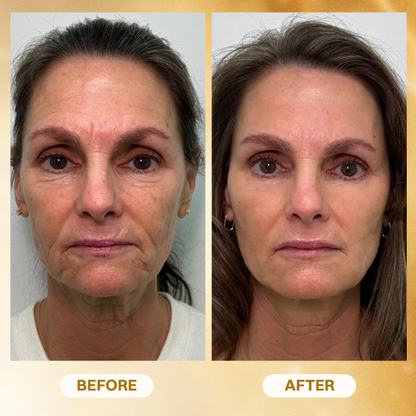 LIMETOW® Anti-Aging Concentrated Serum