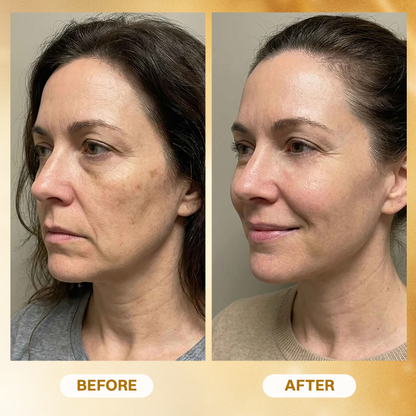 LIMETOW® Anti-Aging Concentrated Serum