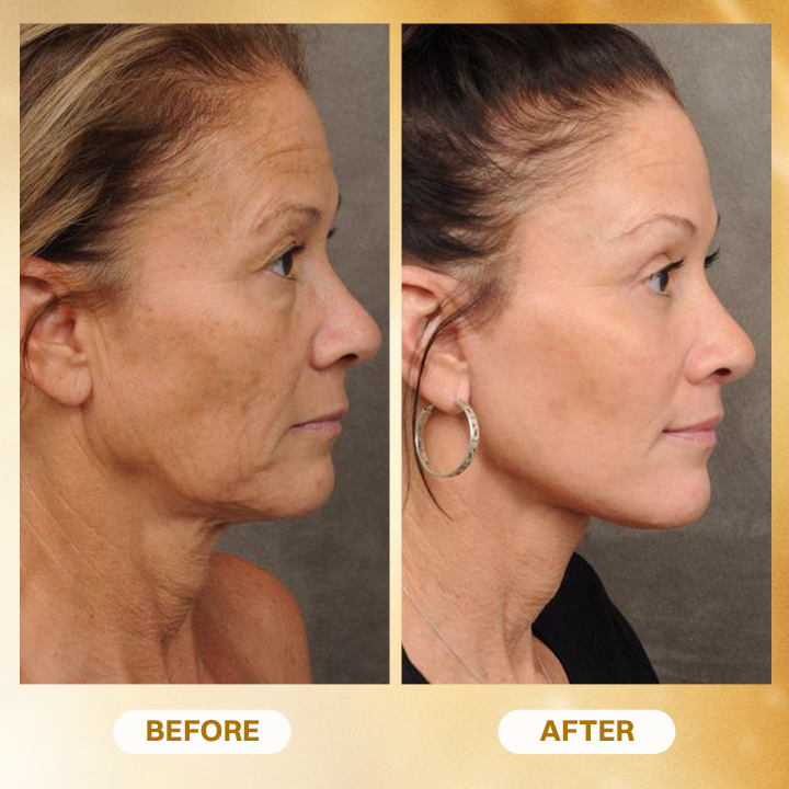 LIMETOW® Anti-Aging Concentrated Serum