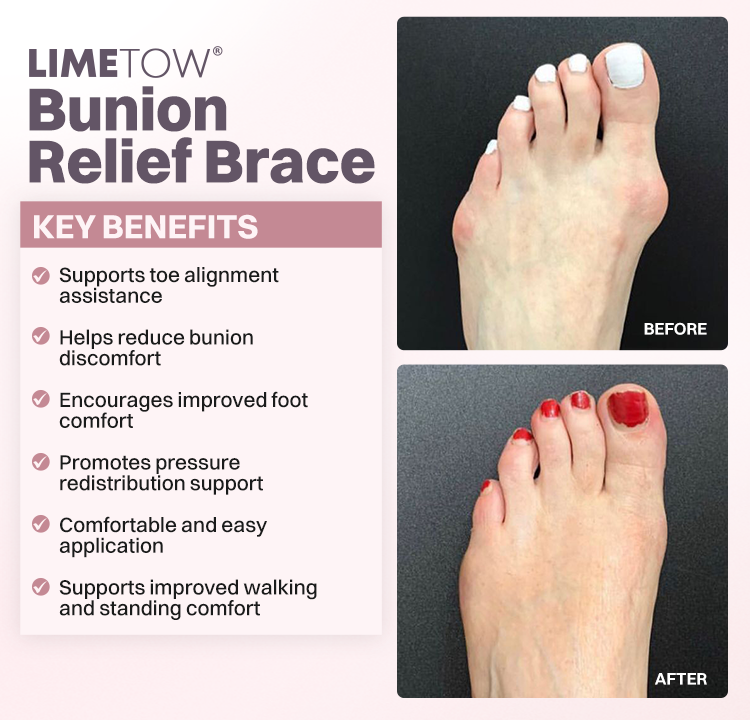 LIMETOW® Bunion Relief Brace