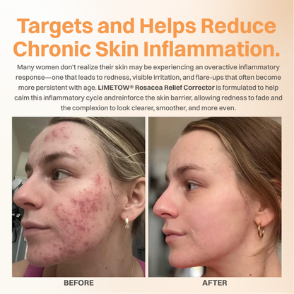 LIMETOW® Rosacea Relief Corrector