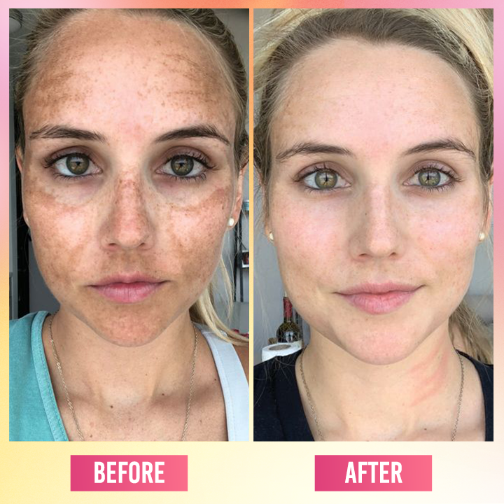 LIMETOW® Face Bright Serum In Cream