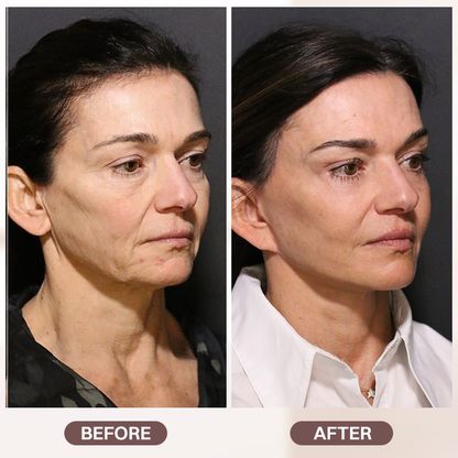 LIMETOW® Retinol Cream