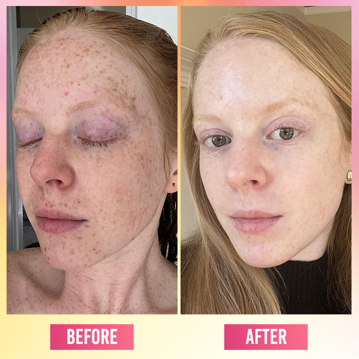 LIMETOW® Face Bright Serum In Cream