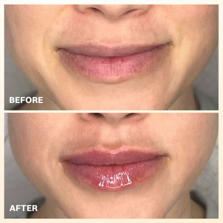 LIMETOW® PROPOLIS LIP BALM