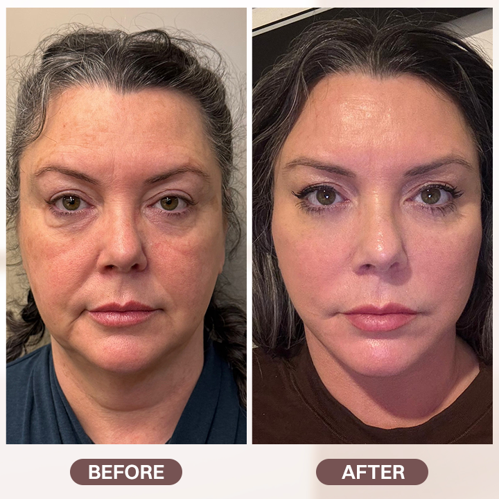 LIMETOW® Retinol Cream