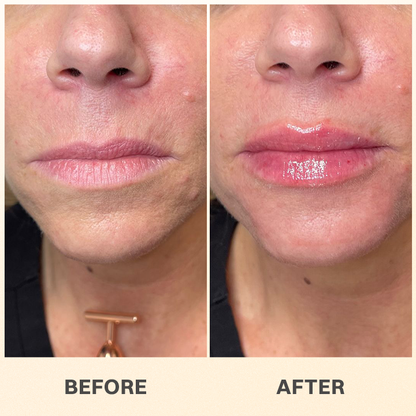 LIMETOW® PROPOLIS LIP BALM
