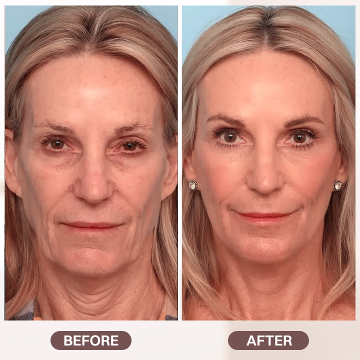 LIMETOW® Retinol Cream