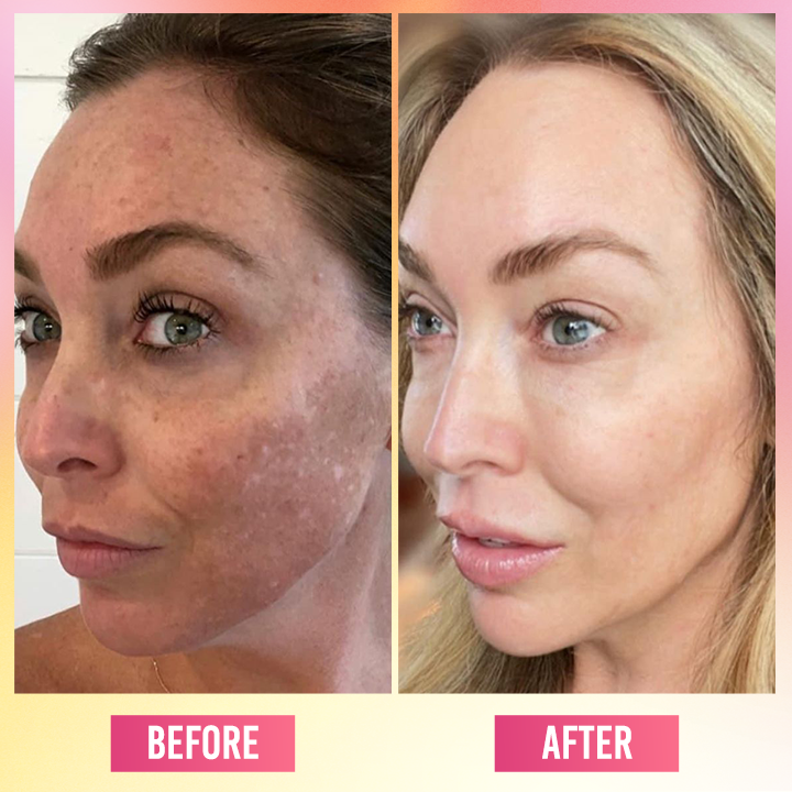 LIMETOW® Face Bright Serum In Cream