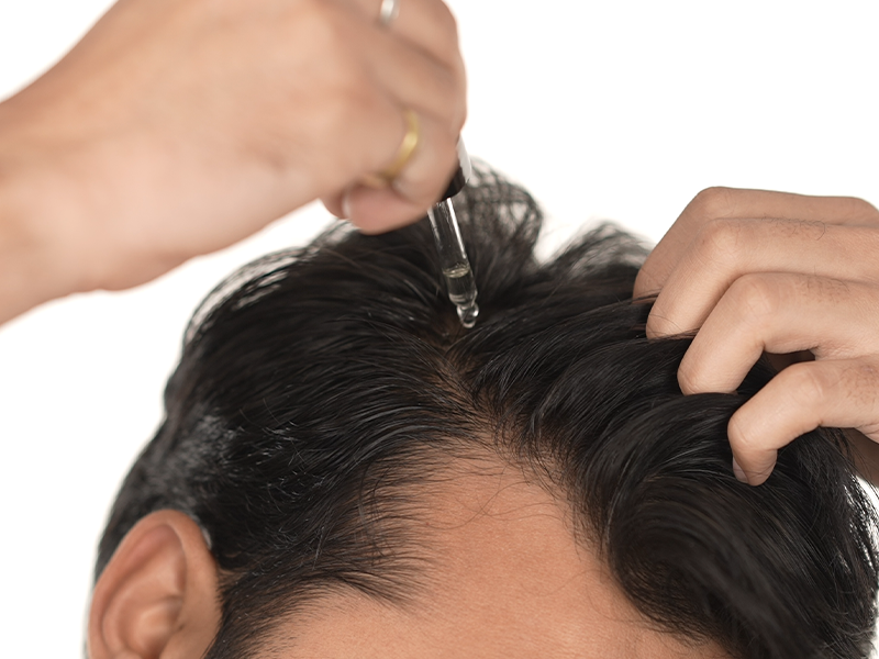 LIMETOW® Hair Growth Serum image LIMETOW® Hair Growth Serum