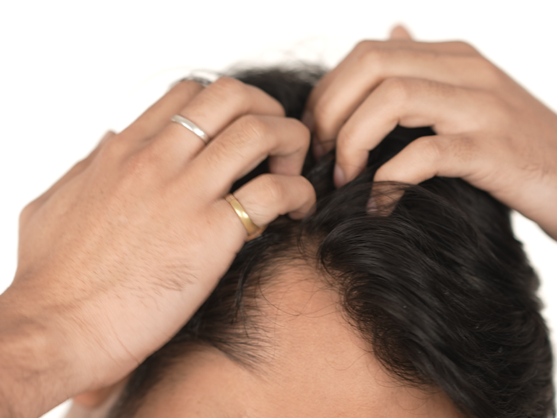 LIMETOW® Hair Growth Serum image LIMETOW® Hair Growth Serum