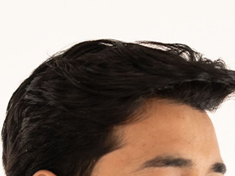 LIMETOW® Hair Growth Serum image LIMETOW® Hair Growth Serum