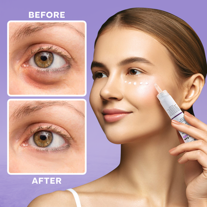 ⏳Last Day Discount⏳LIMETOW™ Under Eye Puffiness Remover