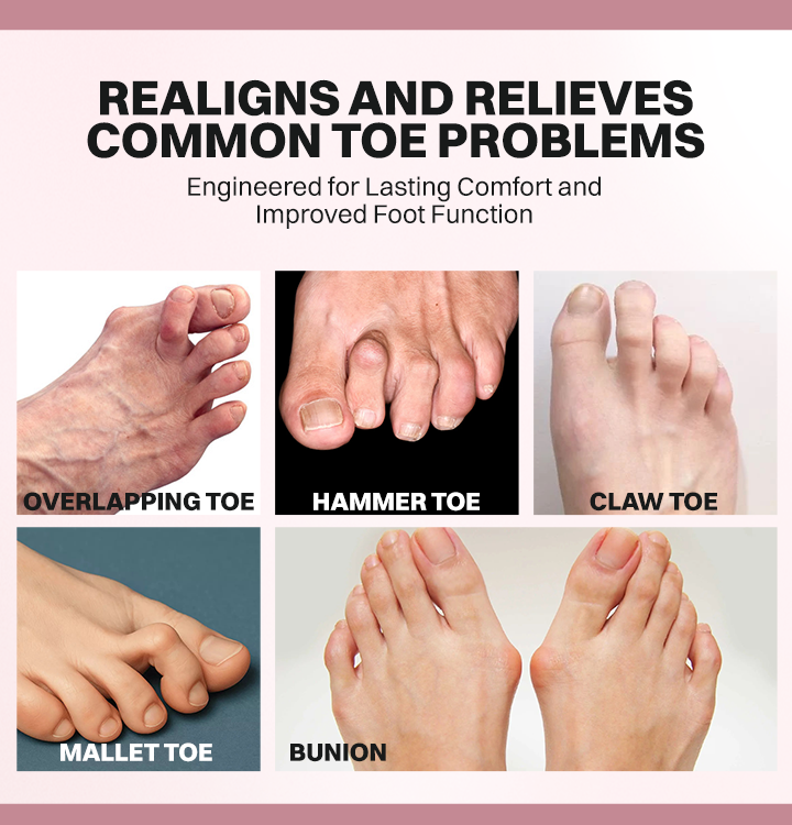 LIMETOW® Bunion Relief Brace