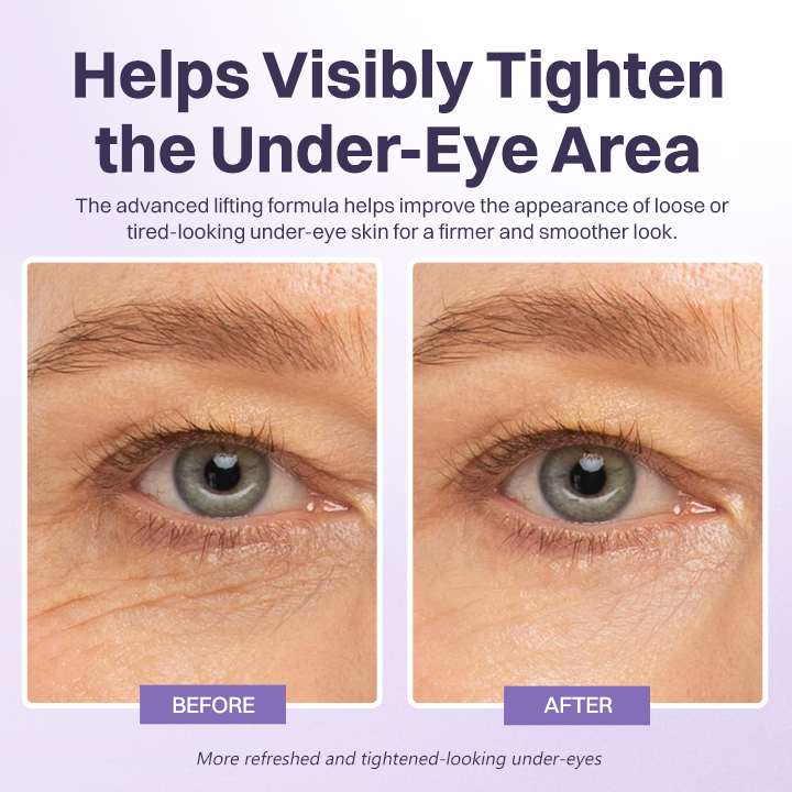 LIMETOW® Instant Lift Eye Gel