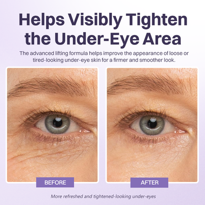 LIMETOW® Instant Lift Eye Gel