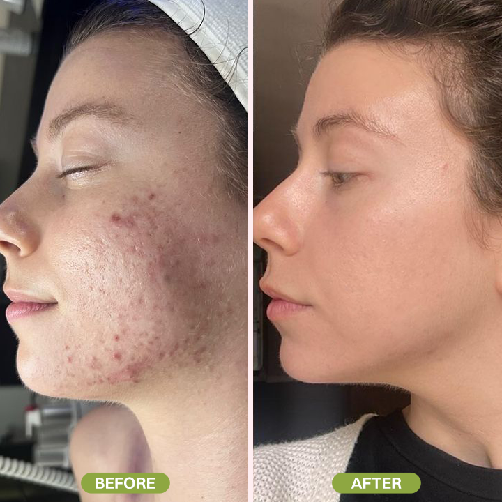 LIMETOW® Retinal Skin Booster Serum