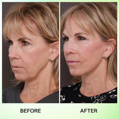 LIMETOW® Botox & Vita-A Retinol Shot Wrinkle-Lift Tightening Cream