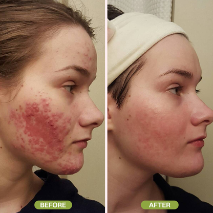 LIMETOW® Retinal Skin Booster Serum