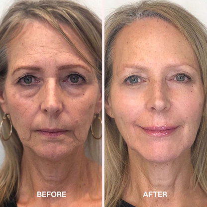LIMETOW® REVERSE-AGING ADAPTIVE FOUNDATION