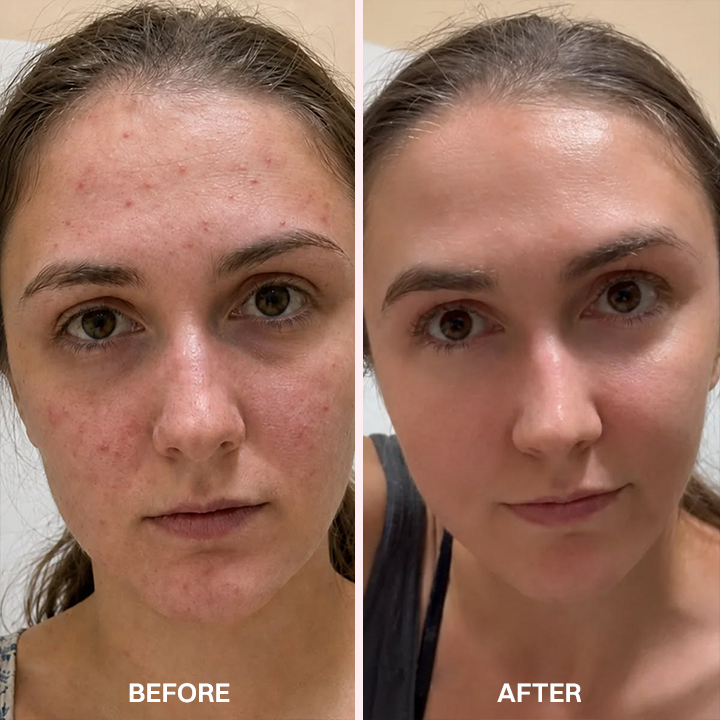 LIMETOW® Advanced Anti-Aging Serum