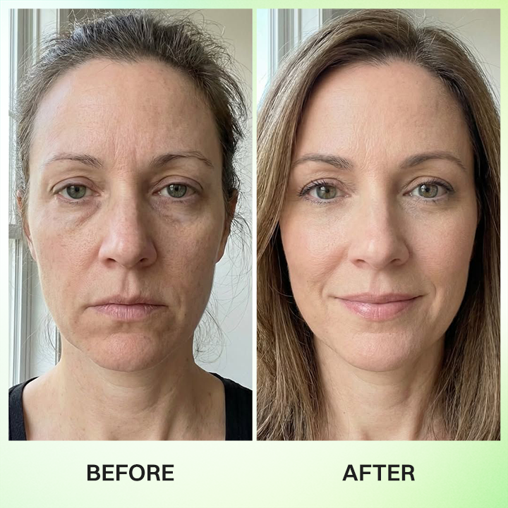 LIMETOW® Botox & Vita-A Retinol Shot Wrinkle-Lift Tightening Cream