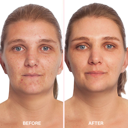 LIMETOW® Advanced Anti-Aging Serum