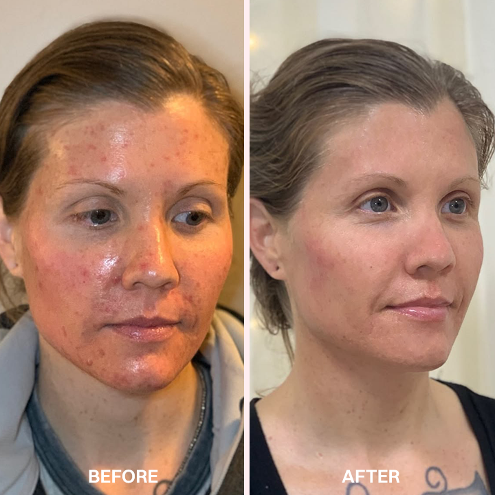 LIMETOW® Advanced Anti-Aging Serum