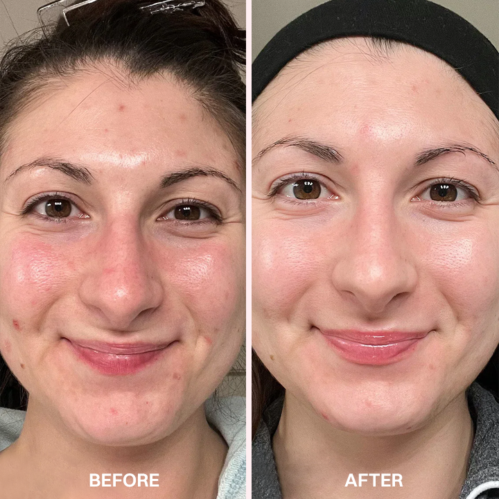 LIMETOW® Advanced Anti-Aging Serum