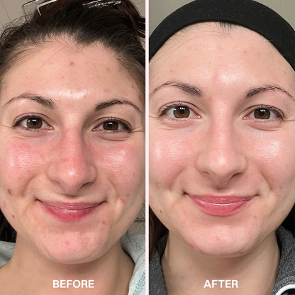 LIMETOW® Advanced Anti-Aging Serum