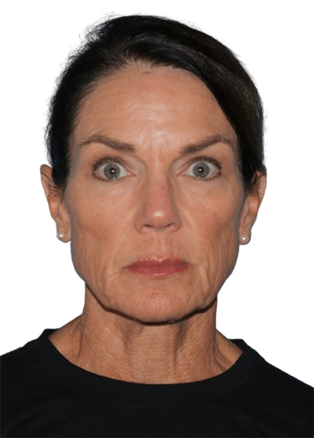 LIMETOW Collagen Face Toner image LIMETOW Collagen Face Toner