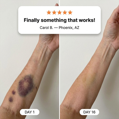 LIMETOW® Bruise Repair & Skin-Strengthening Cream