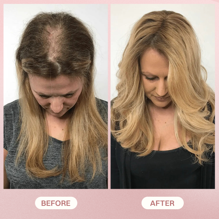 LIMETOW® H-Regrow 2.0