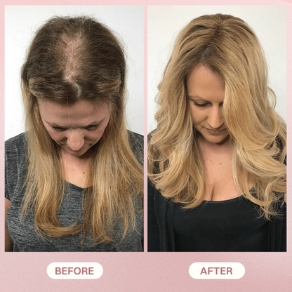 LIMETOW® H-Regrow 2.0