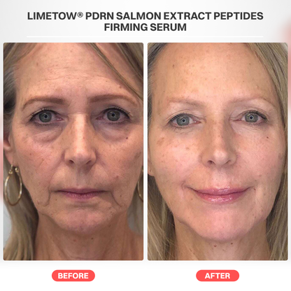 LIMETOW® PDRN Salmon Extract Peptides Firming Serum