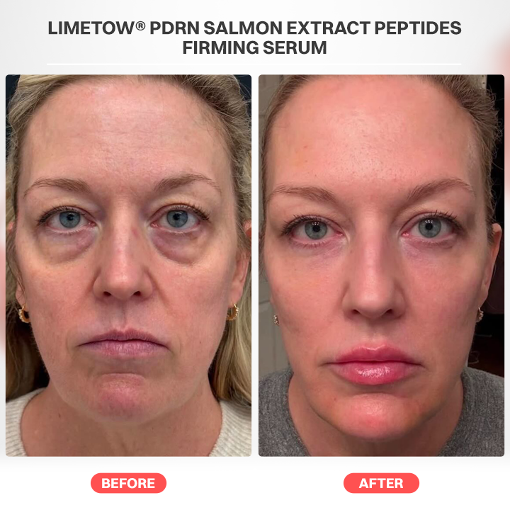 LIMETOW® PDRN Salmon Extract Peptides Firming Serum