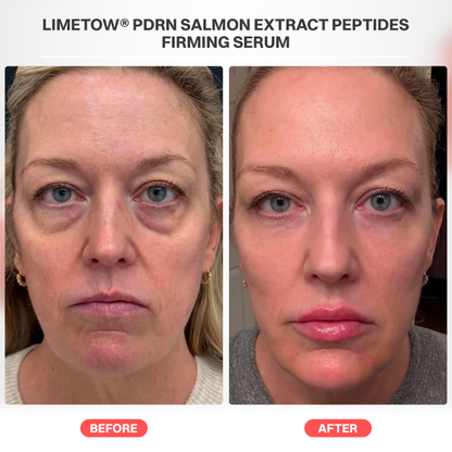 LIMETOW® PDRN Salmon Extract Peptides Firming Serum