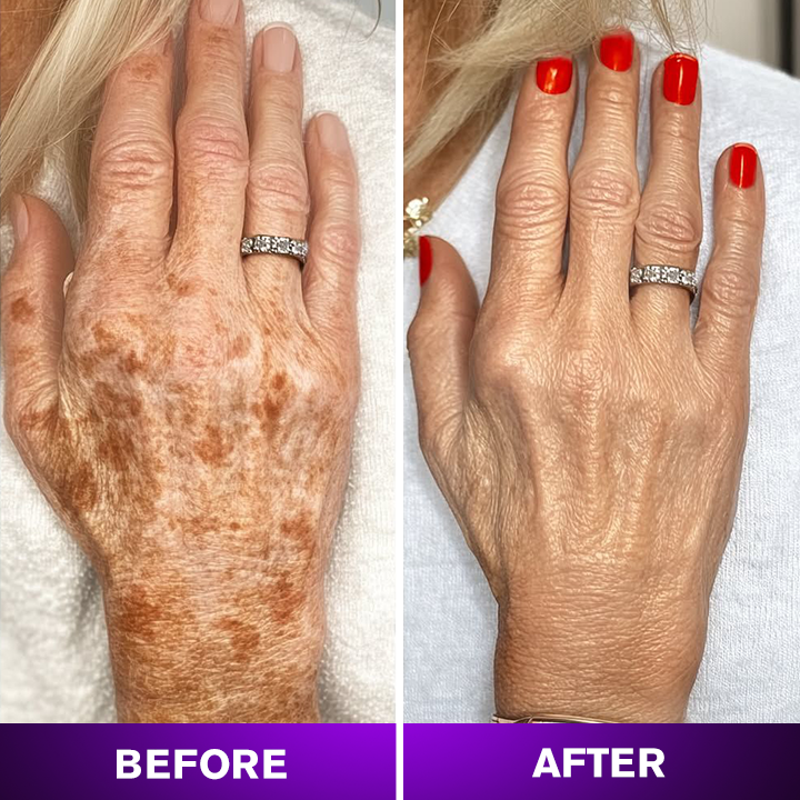 LIMETOW® Body Coverage Perfector