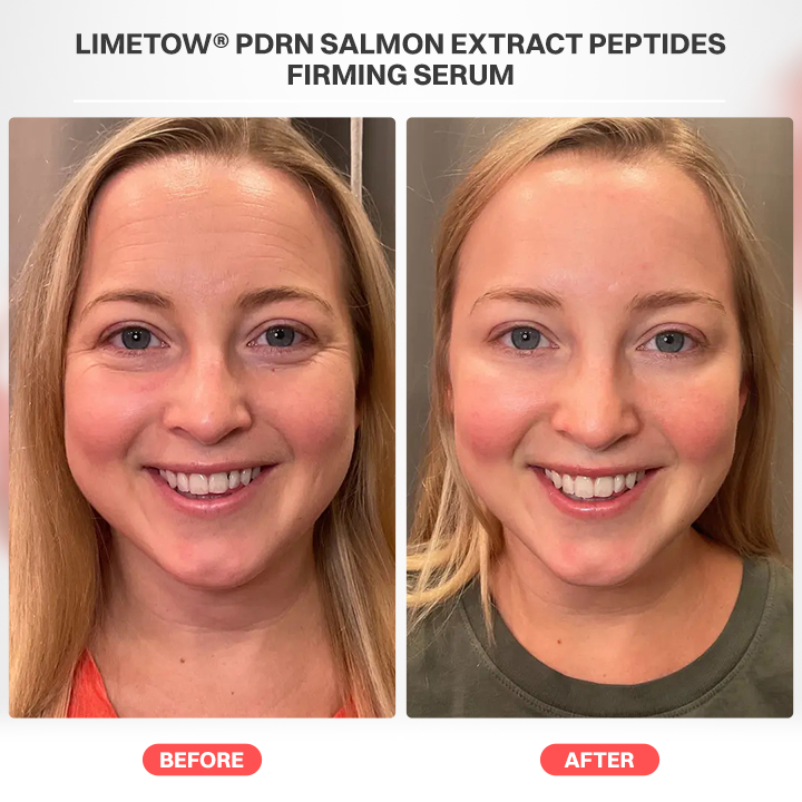 LIMETOW® PDRN Salmon Extract Peptides Firming Serum