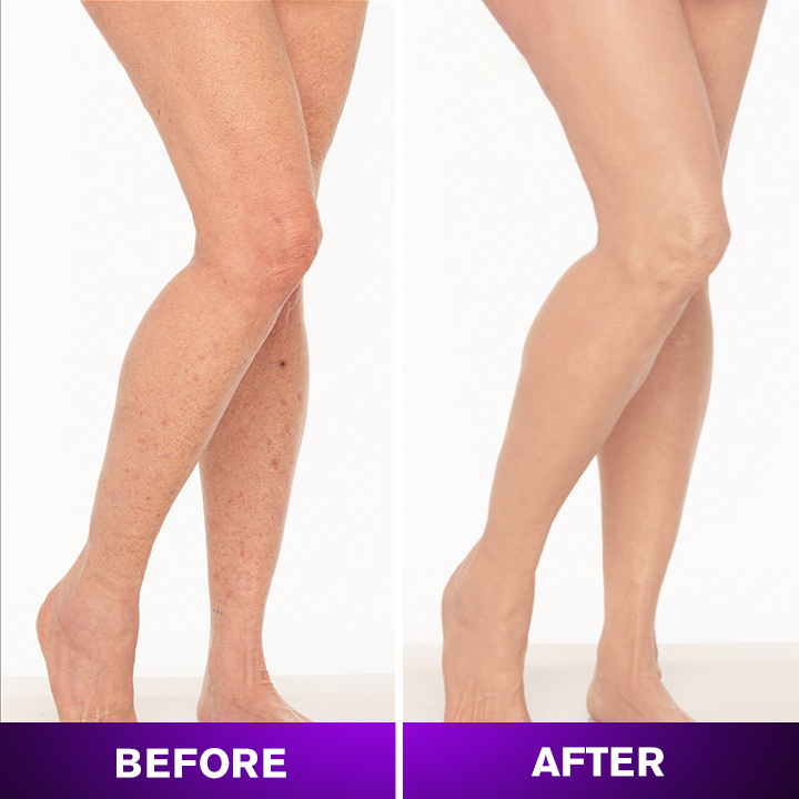 LIMETOW® Body Coverage Perfector
