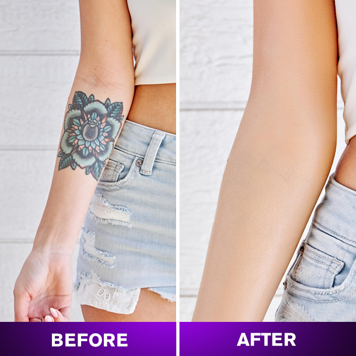 LIMETOW® Body Coverage Perfector
