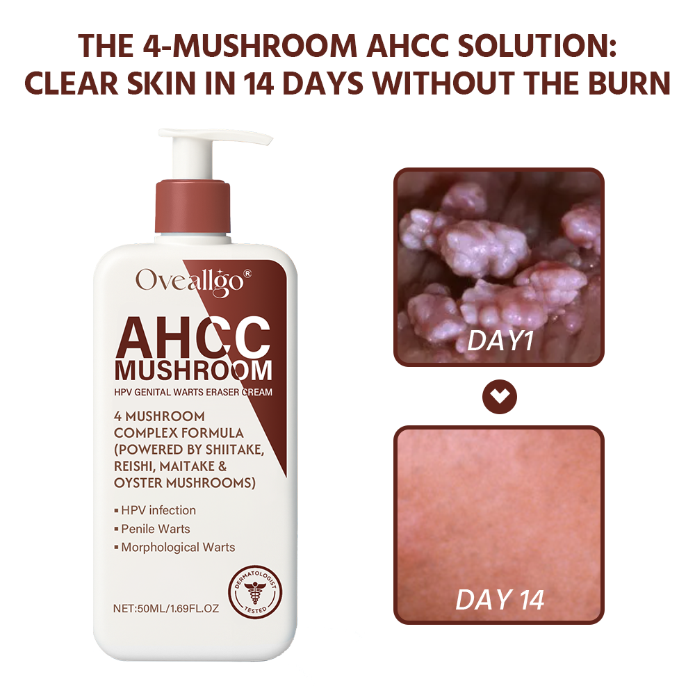 AHCC Mushroom HPV Genital Warts Eraser Cream Pro
