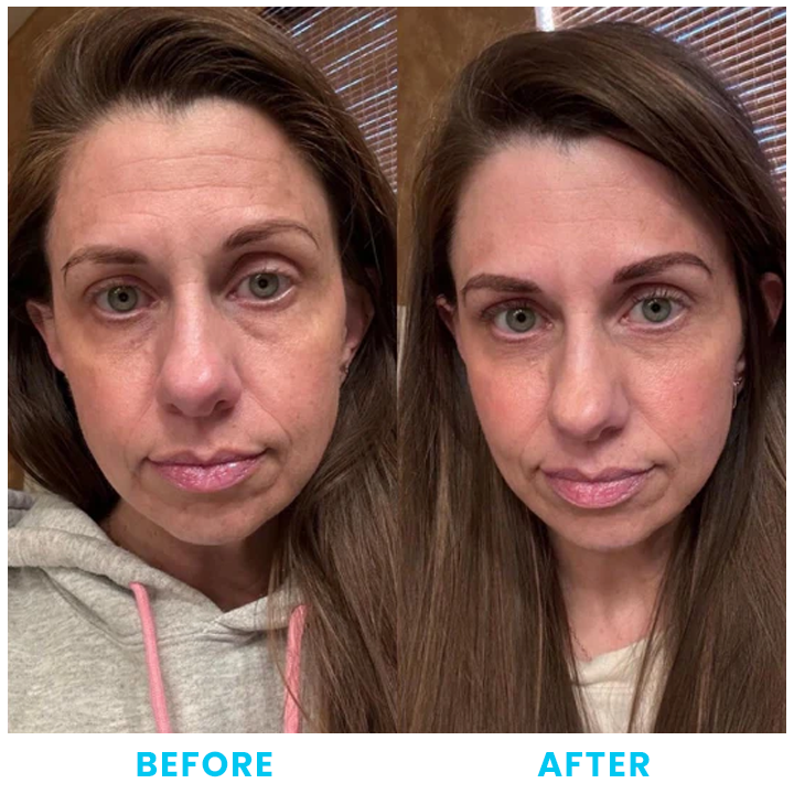 LIMETOW™ Collagen, Retinol & Hyaluronic Acid Cream image LIMETOW™ Collagen, Retinol & Hyaluronic Acid Cream