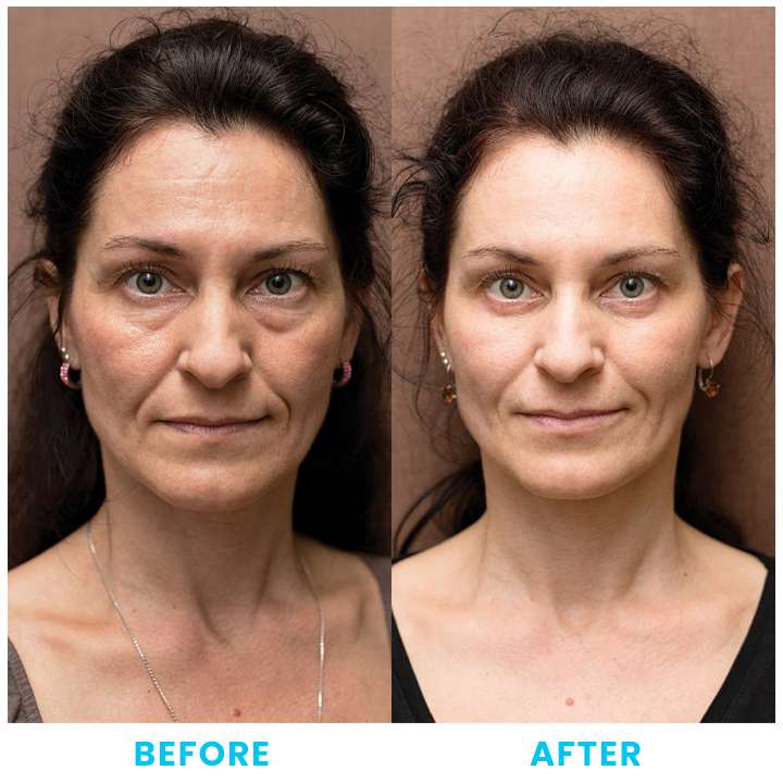 LIMETOW™ Collagen, Retinol & Hyaluronic Acid Cream image LIMETOW™ Collagen, Retinol & Hyaluronic Acid Cream